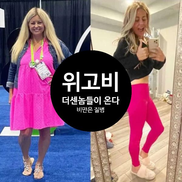  일론머스크도 복용안 위고비! 더 센놈들이 온다!비만을 바라보는 시각! 비만은 당신의 책임이 아니예요.