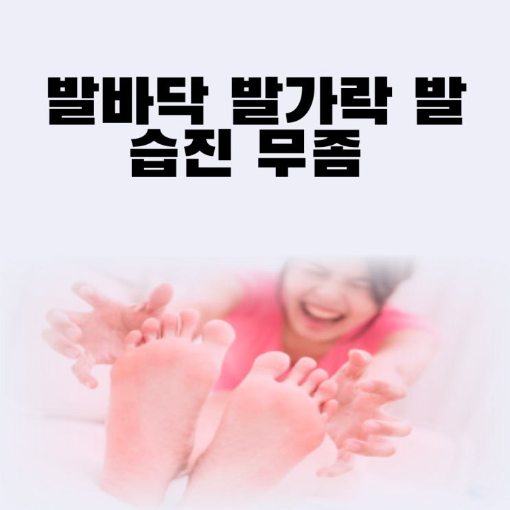 발바닥 발가락 발 습진 무좀 수포 증상 약 연고 치료 예방