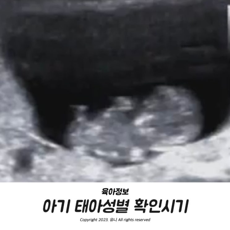  아기 태아 성별 확인 시기 12주 각도법 보는법 알아봐요