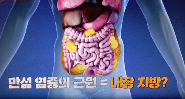 명사수/김경곤교수비만합병증/배우<b>이효춘</b>지중해식단혈관관... 