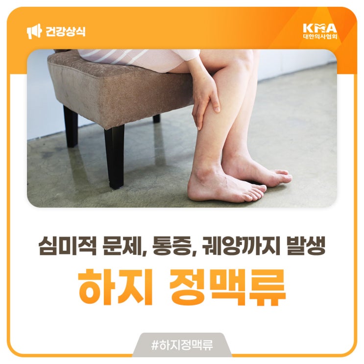  하지 정맥류. 심미적 문제뿐 아니라 통증과 궤양까지 발생