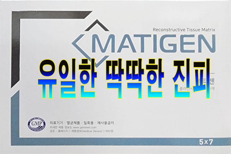  딱딱한 이종진피를 마티젠뿐 입니다 이종도 동종처럼 소프트 합니다