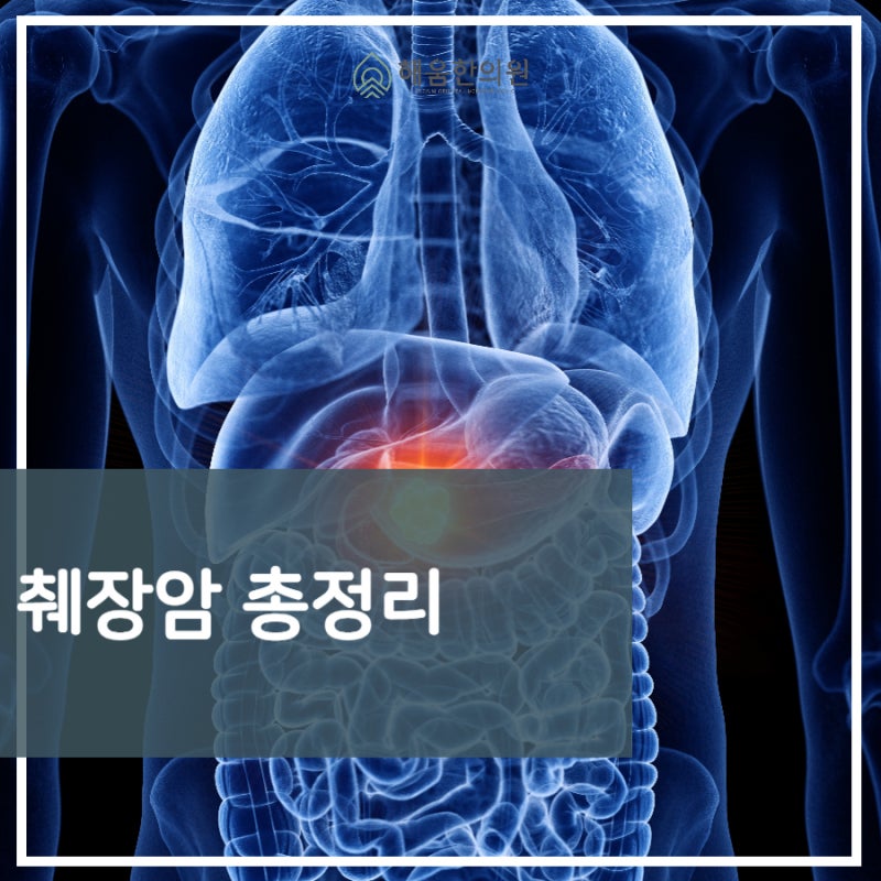 췌장암 등통증 위치, 초기증상과 원인까지 알아봐요 : 네이버 블로그
