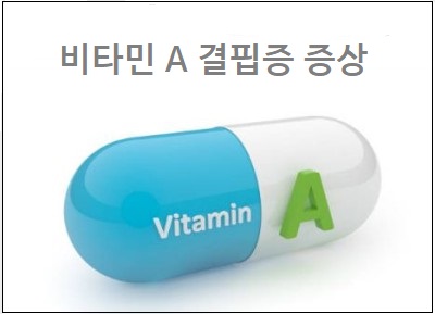 비타민 A 결핍증 비타민 A 결핍 원인 및 치료 상식