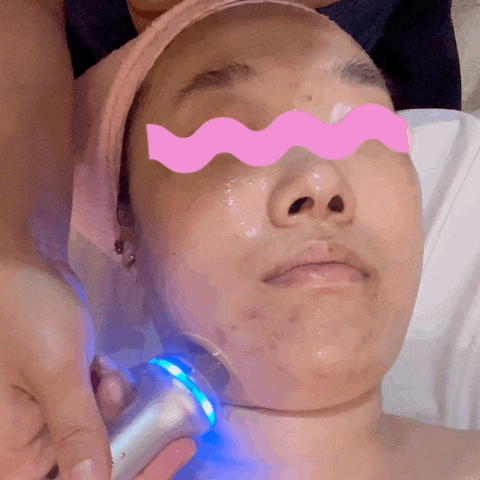  미아피부관리실 바디톡에스테틱 리프팅 윤곽케어 후기