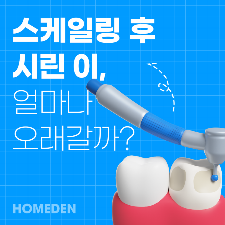  스케일링 후 시린 이, 얼마나 오래갈까?