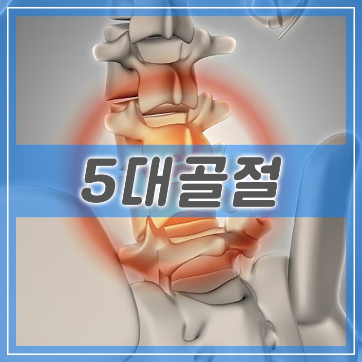  5대골절, 머리 목 흉추 요추 대퇴 골절