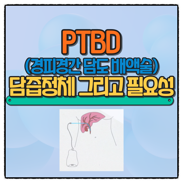  PTBD 경피경간 담도 배액술 목적