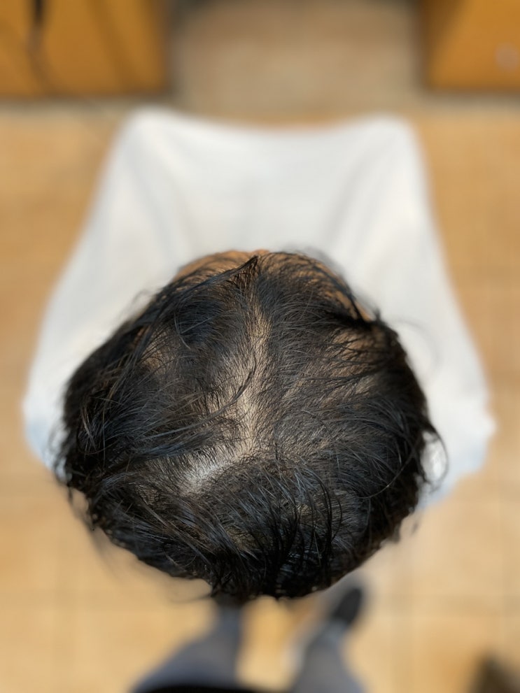  잃어버린 마음의 한가닥까지 채워드려요 남자탈모성형펌 부산사상르네시떼미용실/ 덕포덕천화명대저명지용원진해개금주례감전당감모라학장하단김해녹산장유울산양산덕계가야연산동래온천대연수영해운대안락