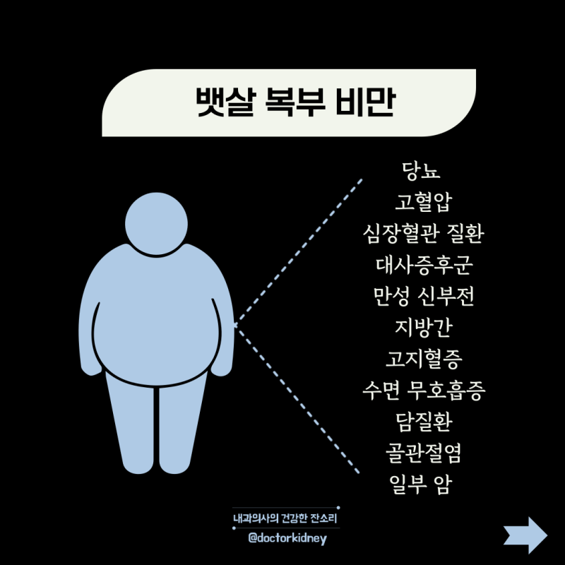복부 비만의 원인을 줄이는 방법 운동보다 식사가 먼저