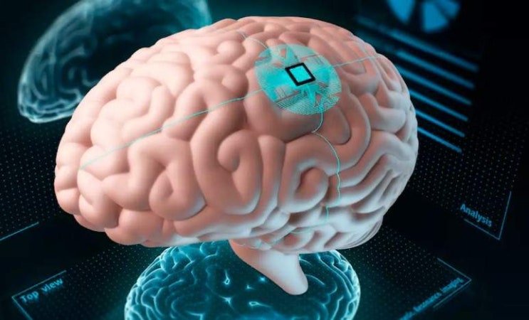 캘리포니아의 두 연구원 팀은 환자의 뇌파를 가로채서 이를 말과 얼굴 표정으로 변환하고 디지털 아바타를 통해 외부화하는 뇌 이식 장치를 설계했습니다…알고 계십니까?