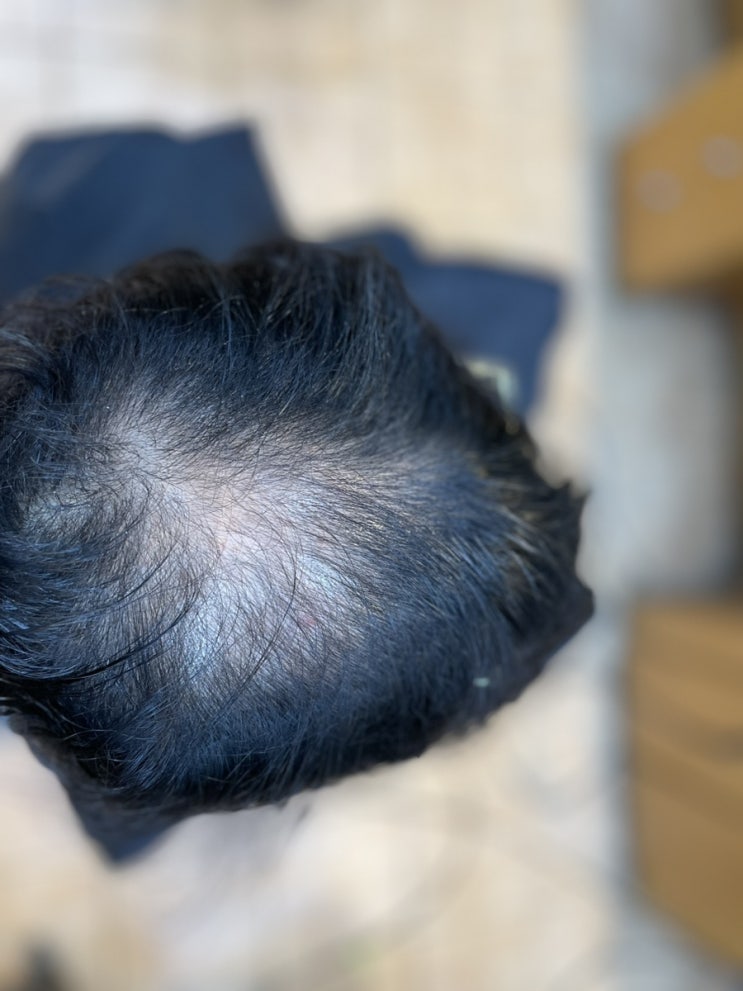  제주도에서 혼자옵서예 남여탈모성형펌 부산사상르네시떼미용실/ 대구진해신항감만녹산대저울산구미양산김해장유덕계밀양경주창원마산사천진주남해하동개금주례당감감전서면전포대연문현연산양정망미동래초읍