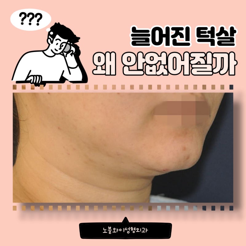 턱살 처짐, 턱살 안빠지는 이유 및 해결법 : 네이버 블로그