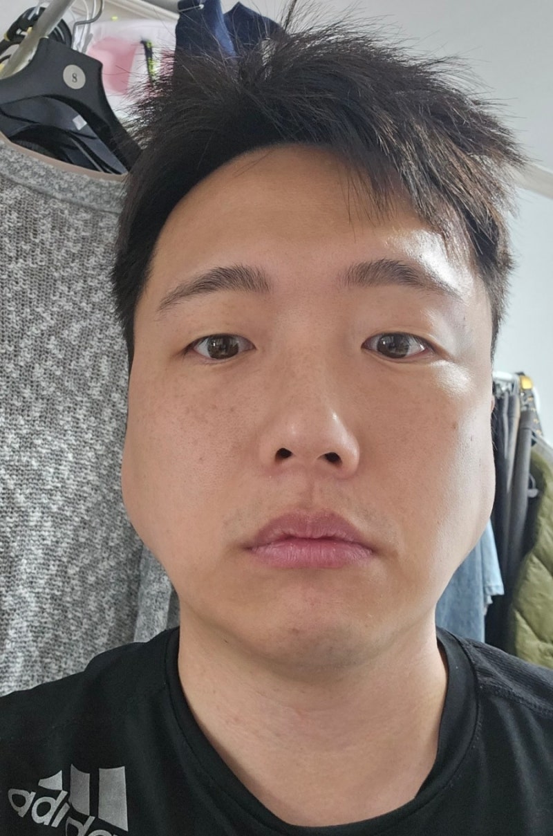 대구 볼거리(이하선염) 병원은 이비인후과로 가세요! 대구 달서구 현이비인후과 방문, 난 내 ....