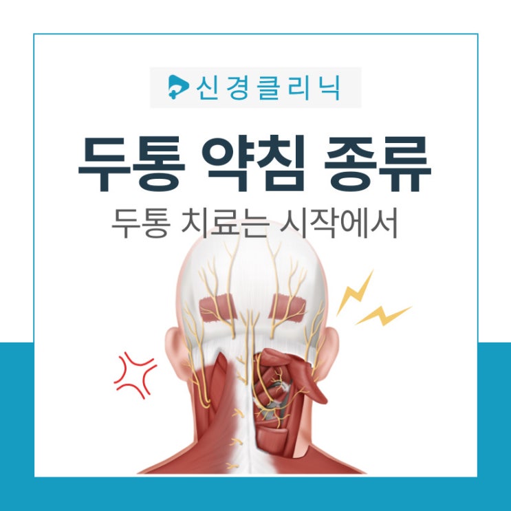  선릉 한티 한의원 | 시작한의원(전 아이두한의원) 두통 약침치료