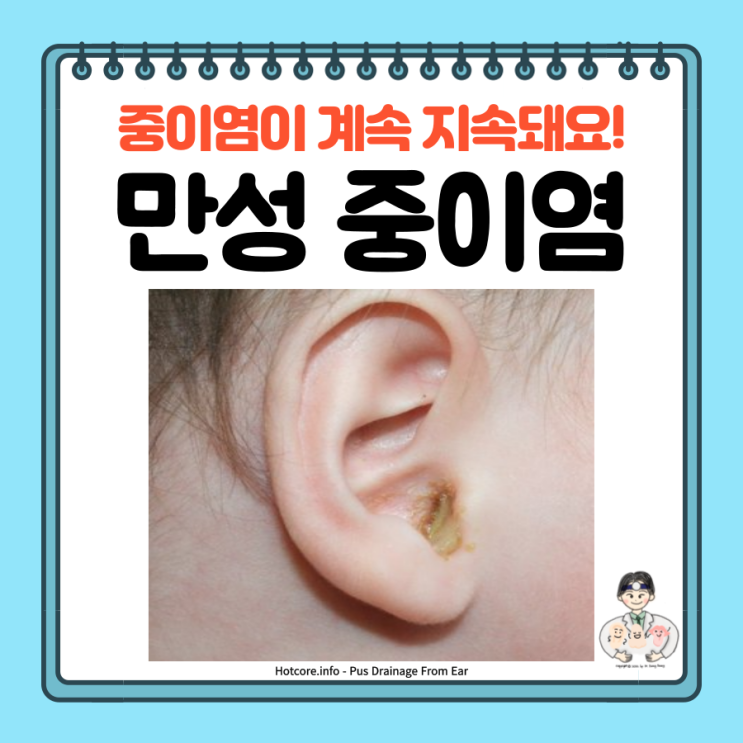  만성 화농성 중이염 원인 증상 검사 치료 수술