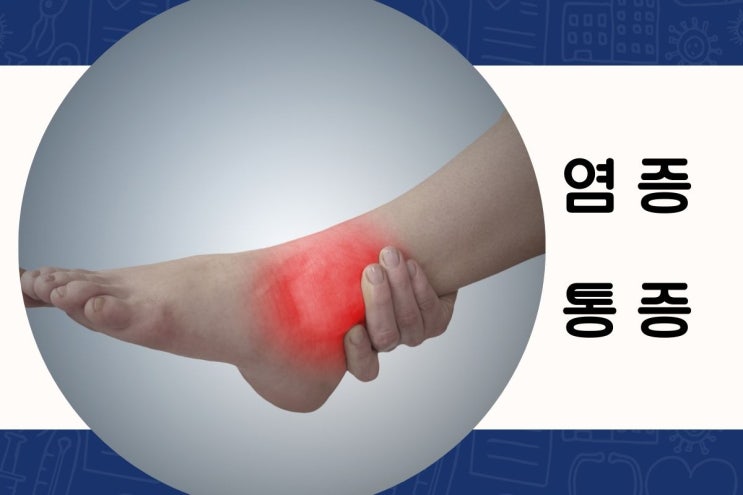  통증에 얼음찜질을 하는 이유