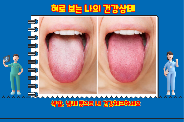 혀 건강 상태 확인 방법 색깔과 냄새로 확인하기