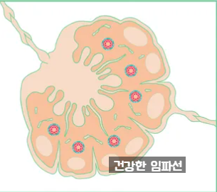임파선(림프절) 부었을때, 임파선 위치, 중요한 역할 알아두기 : 네이버 블로그