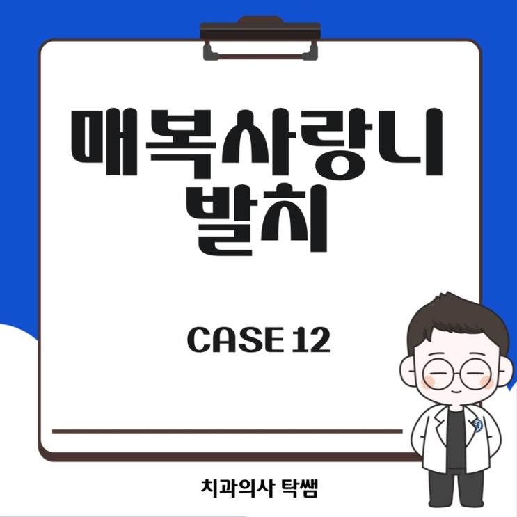  [탁쌤 CASE 12] 충북대 근처 치과 매복 사랑니 발치 케이스