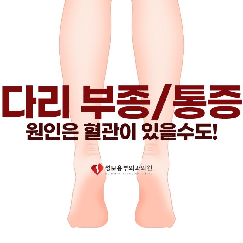 청주하지정맥류추천 다리 통증과 부종이 반복된다면