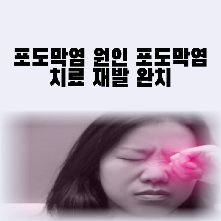  포도막염 원인 포도막염 치료 재발 완치