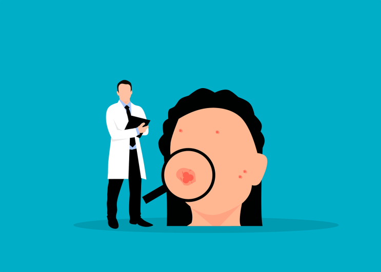  여드름 짜기 없애는법::압출 화농성 좁쌀...Arnuf 아르너프 피부 관리 방법