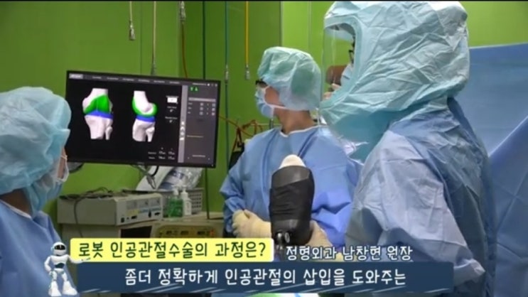 무릎 로봇 인공관절수술 하루 전