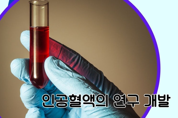  응급상황 인공 혈액의 장점 종류
