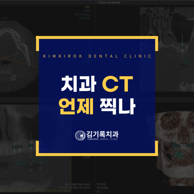 수원인계동치과추천 치과디지털 CT를 꼭 찍어야 하는 대표적 4가지 진료