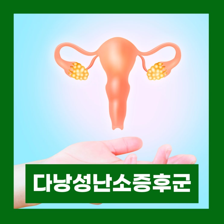  생리 늦어질때 의심해야 할 다낭성난소증후군 증상 및 원인