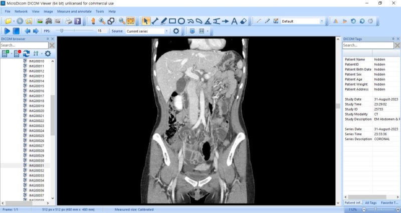 DICOM 파일 뷰어 소개. MicroDicomViewer : 네이버 블로그