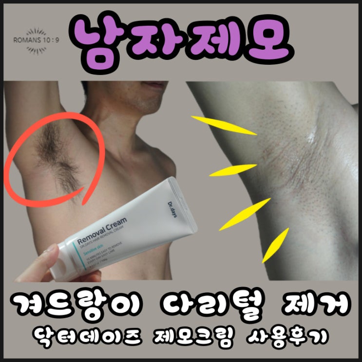  남자제모 겨드랑이 다리털 제모크림 닥터데이즈 사용후기