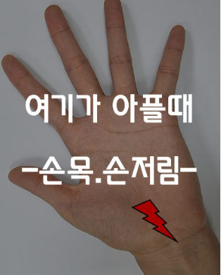 [재활의학과] 손목통증, 손이 저릴때 -2- (목디스크)