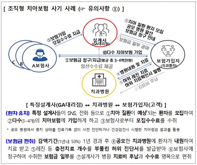 금감원 "임플란트, 레진 등 치과치료 보험사기 주의" 금감원 "임플란트, 레진 등 치과치료 보험사기 주의"