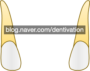 가운데 옆니 : 상악, 하악 측절치, 전치,lateral incisor - 치아형태 시리즈, 치아길이, 치아모양