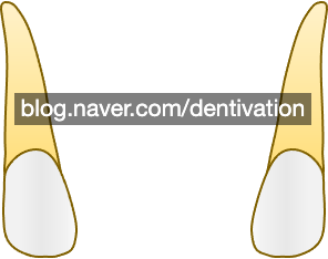  가운데 옆니 : 상악, 하악 측절치, 전치,lateral incisor - 치아형태 시리즈, 치아길이, 치아모양