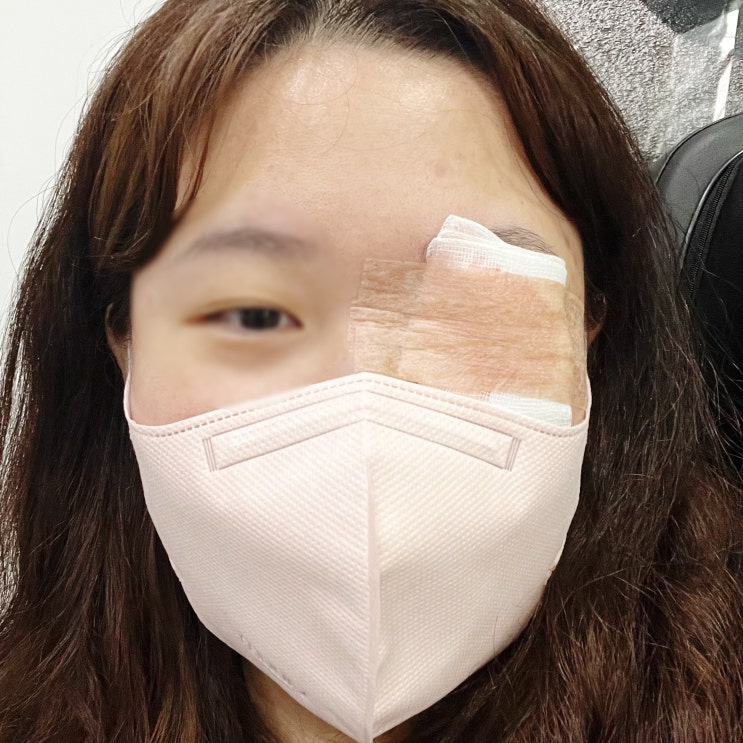  230902 다래끼 조짐