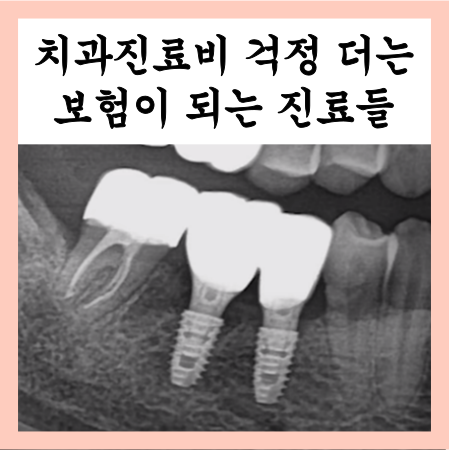  보험이 되는 치과진료들