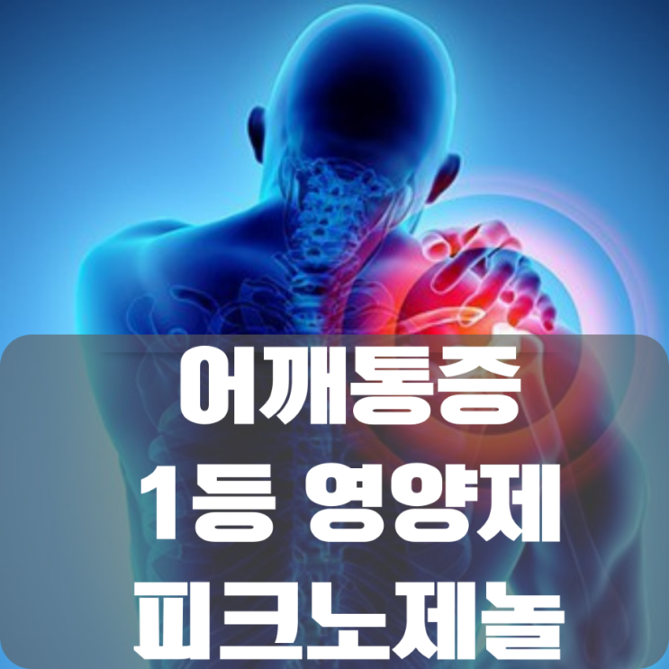  고약사 추천 어깨 관절 통증 영양제 1등은 바로 이것-피크노제놀
