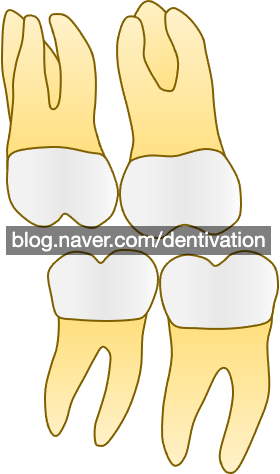 큰어금니, 대구치 : molar - 치아형태 시리즈, 치아길이, 치아모양