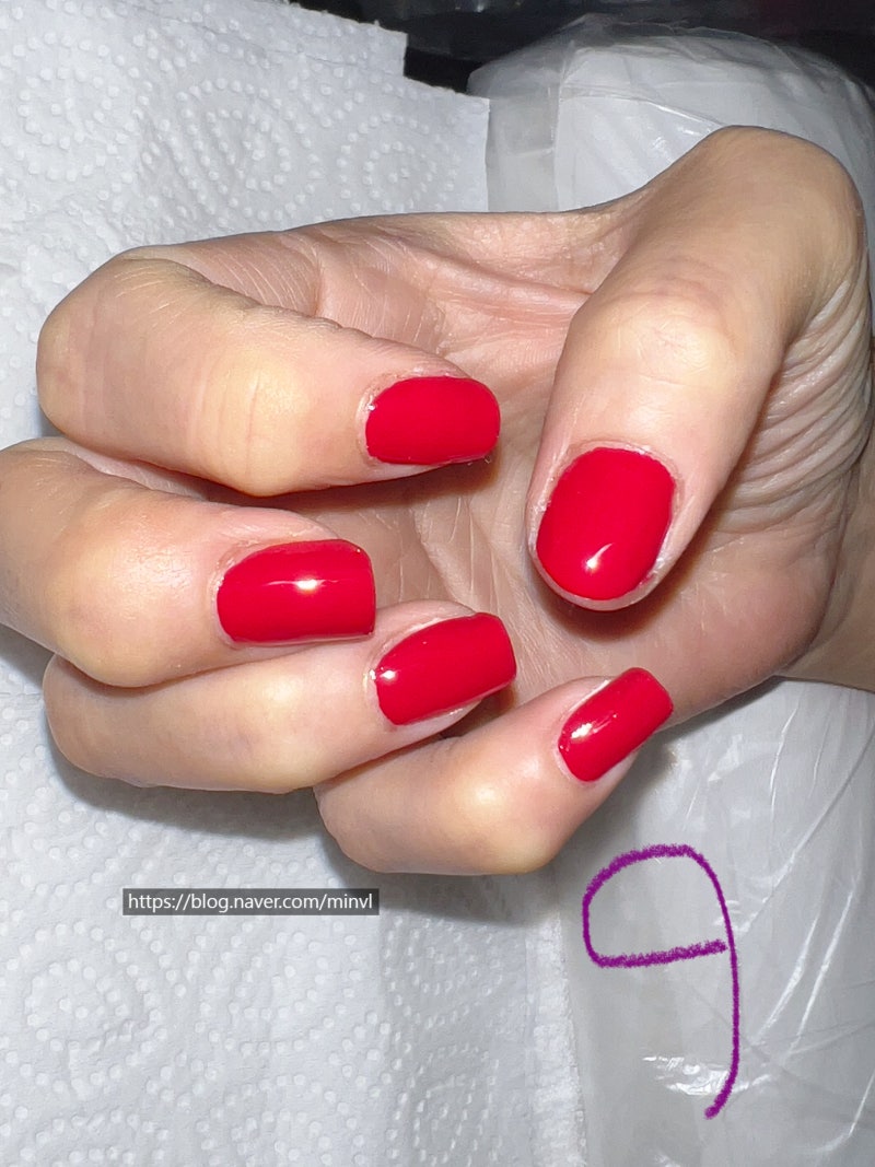 안양내성발톱, 안양무좀발톱, 평촌내성발톱 (@mi_in0909) · Anyang, image size:800x1067