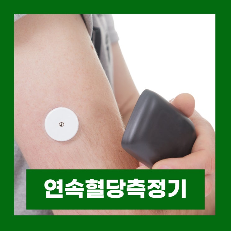  무채혈혈당측정기 원리 및 정확도 연속혈당측정기 장단점