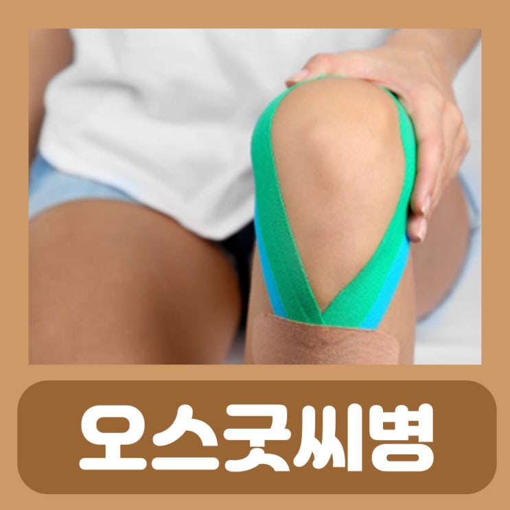  오스굿씨 병 군대 치료 생활방법 오스굿슐라터병