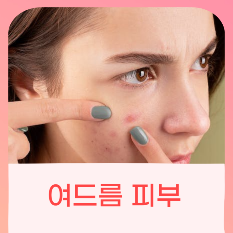  여드름이 생기는 이유? 여드름 피부 좋아지는 법 - 차 추천