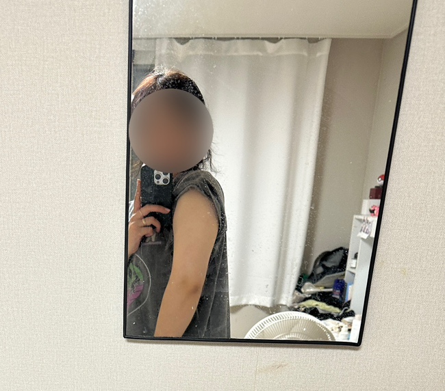  유라인의원 후기 | 팔뚝살빼기에 최고~! 팔뚝컷주사 1회차
