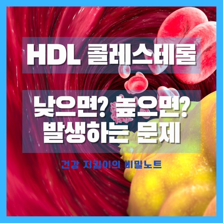  낮은 HDL 콜레스테롤 수치 낮으면? 높으면? 어떤 문제가 발생할까? HDL 콜레스테롤 높이는법