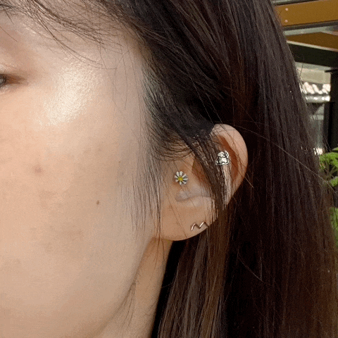  작은귀 귓볼관상 강남 귓볼필러 1차 후기
