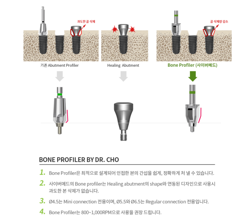 [Item] Bone profiler by CYS (조용석 본프로파일러 버) : 네이버 블로그