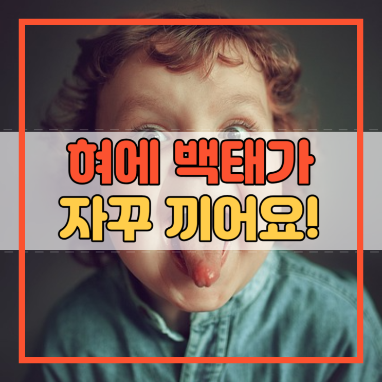  혀에 백태가 자꾸 끼어요. 구강 관리 방법!